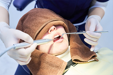 歯科検診を受けている女性